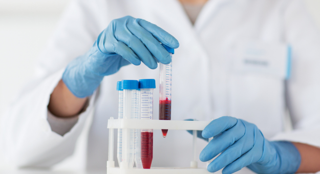 Blood Lab Testing Consultation