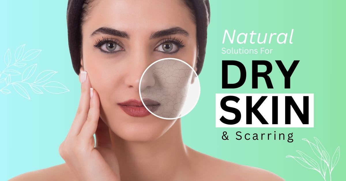 Natural Solutions for Dry Skin and Scarring Naturopathic Care in Canada